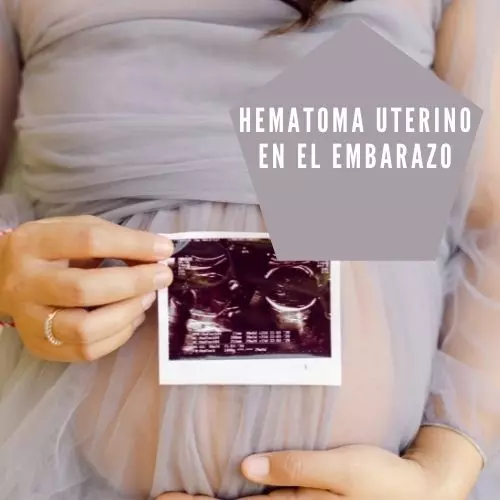 Hematoma uterino en el embarazo [2022]