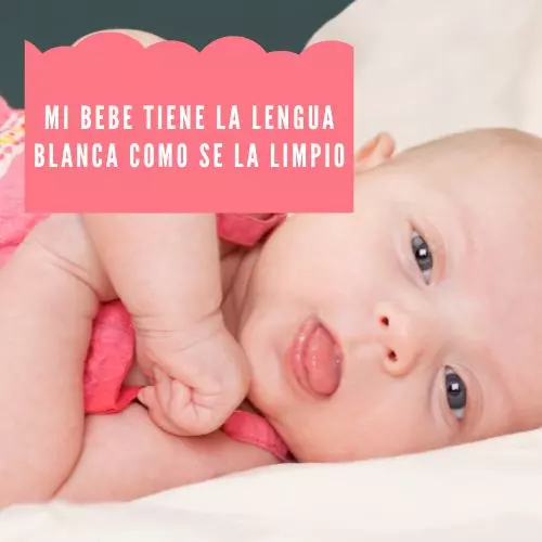 Mi Bebe Tiene La Lengua Blanca Como Se La Limpio [2022]